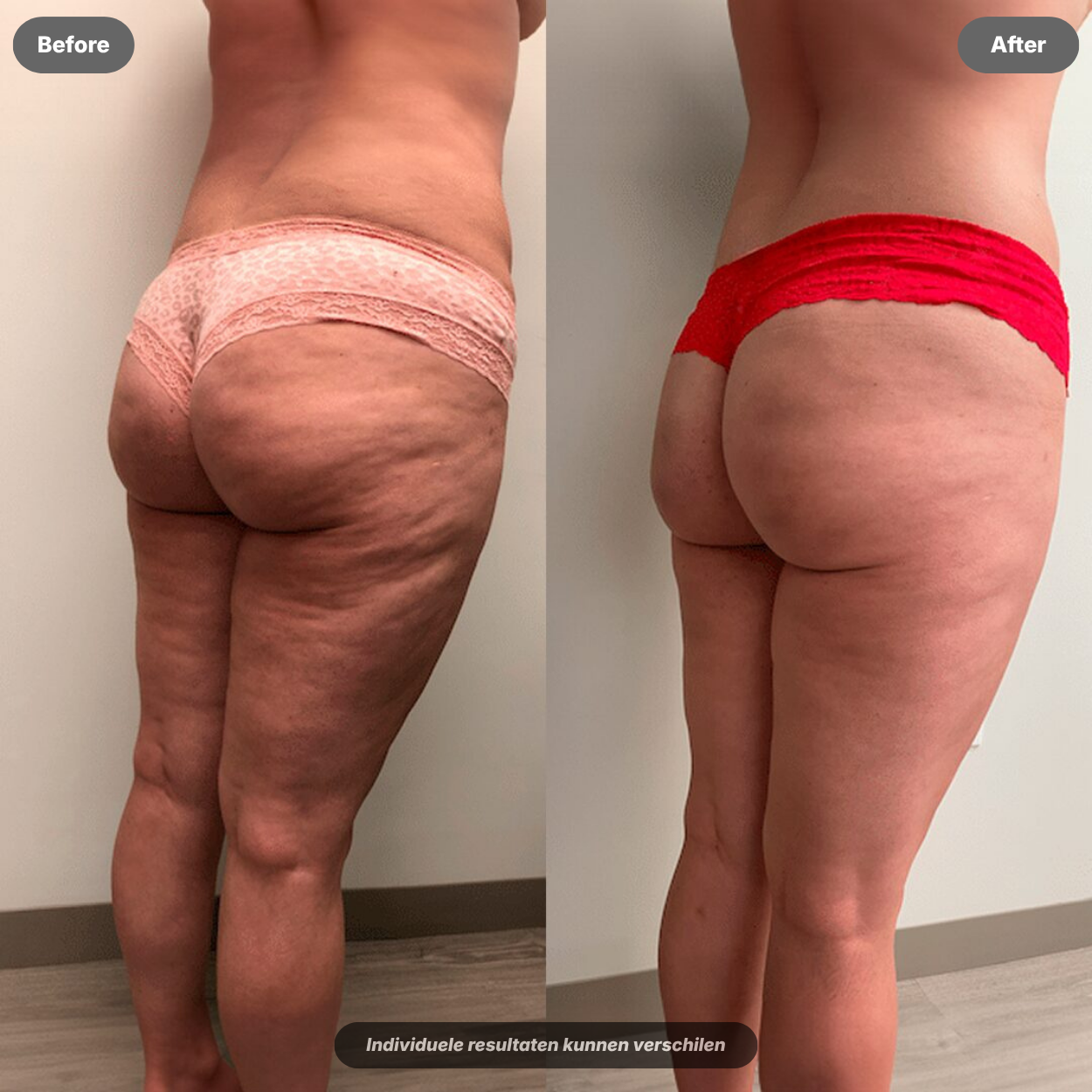 Sculptiq™ 3-in-1
