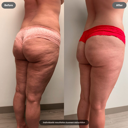 Sculptiq™ 3-in-1